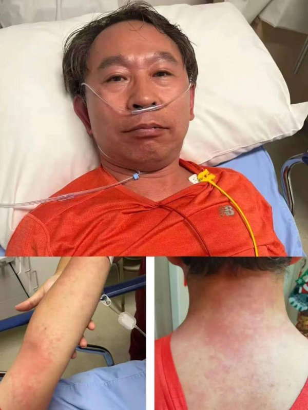 汇盈策略  协和医院专家吃头孢遇险：我成了被抢救的人！分享惊险经历并提醒