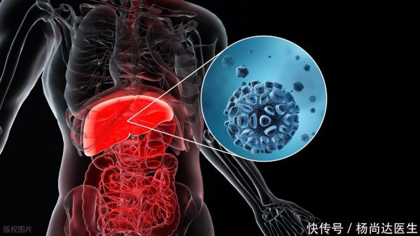 恒正网 提醒：肝良性肿瘤患者，夜间或会出现4类不适，建议就医评估